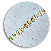 Chaetoceros microscope