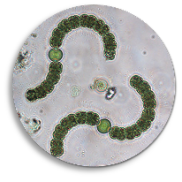 Dolichospermum microscope