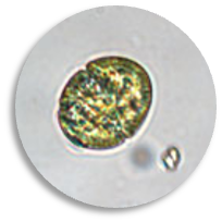 Margalefidinium microscope