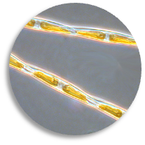Pseudo-nitzschia microscope